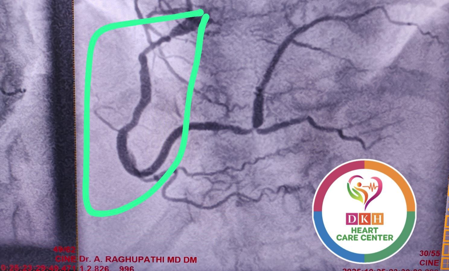Medical Angiogram Image 1